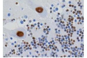 Image no. 2 for anti-Heterogeneous Nuclear Ribonucleoprotein U (Scaffold Attachment Factor A) (HNRNPU) antibody (ABIN108577)