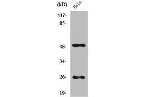 Western Blot analysis of Hela cells using Clusterin Polyclonal Antibody (Clusterin anticorps  (C-Term))