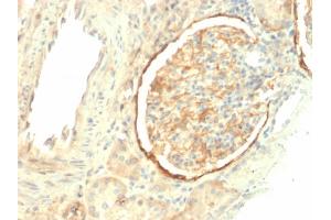 Formalin-fixed, paraffin-embedded human Kidney stained with CD61 Mouse Monoclonal Antibody (ITGB3/2145).