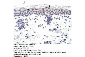 Human Skin (ZNF223 anticorps  (N-Term))