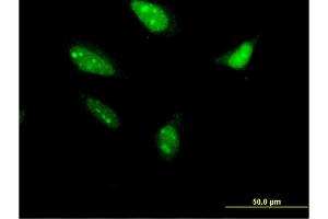 Immunofluorescence of monoclonal antibody to RNF212 on HeLa cell.