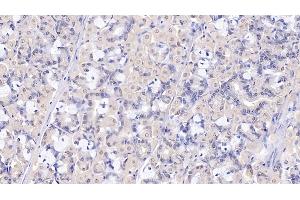 Detection of SELP in Human Stomach Tissue using Polyclonal Antibody to P-Selectin (SELP)