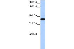 WB Suggested Anti-THEX1 Antibody Titration: 0. (ERI1 anticorps  (N-Term))