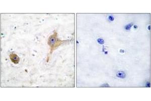 Immunohistochemistry analysis of paraffin-embedded human brain tissue, using GABA-B Receptor Antibody.