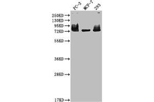 Western Blot Positive WB detected in: PC-3 whole cell lysate, MCF-7 whole cell lysate, 293 whole cell lysate All lanes: MEN1 antibody at 1:2000 Secondary Goat polyclonal to rabbit IgG at 1/50000 dilution Predicted band size: 69, 68, 64 kDa Observed band size: 75 kDa (Recombinant Menin anticorps)