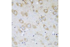 Immunohistochemistry of paraffin-embedded mouse brain using TMOD3 antibody at dilution of 1:100 (40x lens). (TMOD3 anticorps)