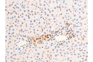 ABIN6256552 and ABIN6267251 at 1/100 staining rat liver tissue sections by IHC-P. (CHEK2 anticorps  (pThr383))