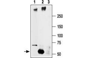 Immunoprecipitation of rat brain lysate: - 1. (SCN2A anticorps  (Intracellular))