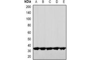 Western blot analysis of CNOT7 expression in HeLa (A), HuvEc (B), DKD (C), mouse brain (D), rat brain (E) whole cell lysates. (CNOT7 anticorps  (N-Term))