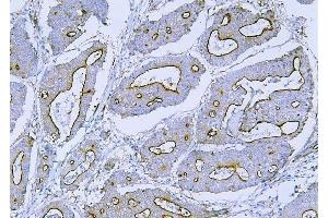 IHC analysis of Filamin B/FLNB using anti-Filamin B/FLNB antibody (ABIN7601607).