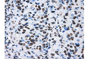 Image no. 15 for anti-ATP Synthase, H+ Transporting, Mitochondrial F1 Complex, beta Polypeptide (ATP5B) antibody (ABIN1496766)