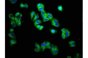 Immunofluorescence staining of HepG2 cells with ABIN7172182 at 1:166, counter-stained with DAPI. (TRHR anticorps  (AA 320-398))