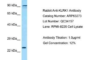 Western Blotting (WB) image for anti-Killer Cell Lectin-Like Receptor Subfamily K, Member 1 (KLRK1) (C-Term) antibody (ABIN2789431) (KLRK1 anticorps  (C-Term))