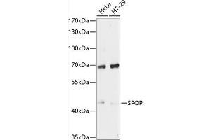 Western blot analysis of extracts of various cell lines, using SPOP antibody (ABIN6130702, ABIN6148373, ABIN6148375 and ABIN6215681) at 1:3000 dilution. (SPOP-B anticorps  (AA 175-374))