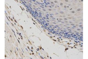 Immunohistochemistry (IHC) image for anti-Second Mitochondria-Derived Activator of Caspase (DIABLO) antibody (ABIN1872269) (DIABLO anticorps)