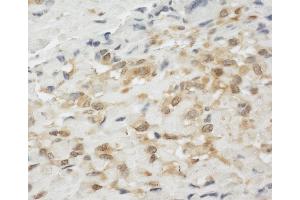 Immunohistochemistry (IHC) image for anti-Lipoma-preferred partner (LPP) (AA 75-125) antibody (ABIN7453721)