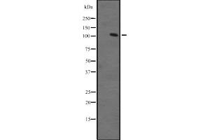 Western blot analysis of ZFPM1 expression in Ant fetal muscle lysate ;,The lane on the left is treated with the antigen-specific peptide. (ZFPM1 anticorps  (Internal Region))
