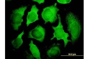 Immunofluorescence of monoclonal antibody to KIAA0101 on HeLa cell.