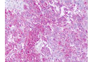 Anti-GPR161 antibody IHC of human adrenal.