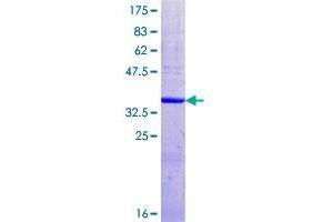 Image no. 1 for Fukutin Related Protein (FKRP) (AA 396-494) protein (GST tag) (ABIN1354146)
