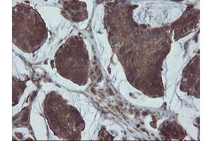 Image no. 9 for anti-Prefoldin Subunit 3 (PFDN3) antibody (ABIN1501706)