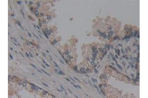 anti-Nucleoporin 155kDa (NUP155) (AA 1154-1379) antibody