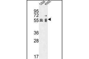 TBCE Antibody (Center) (ABIN653623 and ABIN2842978) western blot analysis in CEM,K562 cell line lysates (35 μg/lane). (TBCE anticorps  (AA 364-392))