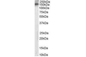 Image no. 1 for anti-Receptor Protein Tyrosine Phosphatase (PTPRT) (Internal Region) antibody (ABIN374470) (PTPRT anticorps  (Internal Region))