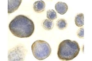 Immunocytochemistry of CXCR4 in HeLa cells with AP30266PU-N CXCR4 antibody at 2 μg/ml.