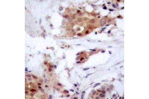 Immunohistochemistry (IHC) image for anti-Nucleoporin 62kDa (NUP62) antibody (ABIN7308108)