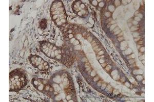 Image no. 2 for anti-Ribosomal Protein L19 (RPL19) (AA 1-101) antibody (ABIN465969)