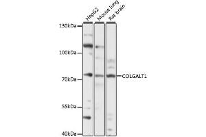Western blot analysis of extracts of various cell lines, using COLG antibody (ABIN7267480) at 1:1000 dilution. (GLT25D1 anticorps  (AA 30-230))