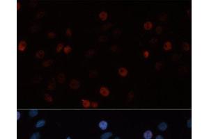 Immunofluorescence analysis of HeLa cells using DNMT3B Polyclonal Antibody at dilution of 1:100. (DNMT3B anticorps)