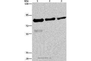 Western blot analysis of Hela, LoVo and HepG2 cell, using FASTKD2 Polyclonal Antibody at dilution of 1:500