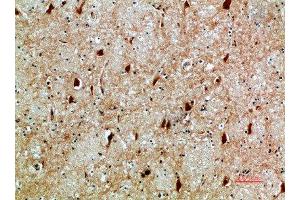 Immunohistochemical analysis of paraffin-embedded human-brain, antibody was diluted at 1:200 (NFAT5 anticorps  (AA 1268-1341))