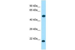 WB Suggested Anti-ALG10B Antibody Titration: 1. (ALG10B anticorps  (N-Term))