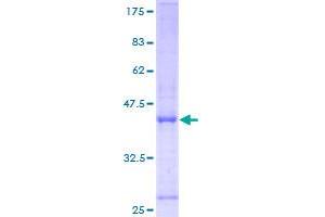 Image no. 1 for Hypoxia Up Regulated 1 (HYOU1) (AA 1-147) protein (GST tag) (ABIN1307314)