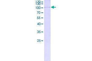 Image no. 1 for Coiled-Coil Domain Containing 36 (CCDC36) (AA 1-584) protein (GST tag) (ABIN1348289)
