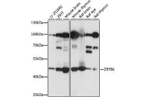 Western blot analysis of extracts of various cell lines, using ZBTB6 antibody (ABIN7271438) at 1:1000 dilution. (ZBTB6 anticorps  (AA 1-220))