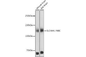 Western blot analysis of extracts of various cell lines, using SLC4 / NBC antibody (ABIN6129130, ABIN6148013, ABIN6148014 and ABIN6220962) at 1:1000 dilution.