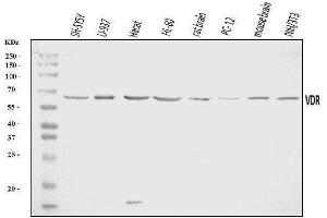 Western blot analysis of Vitamin D Receptor/VDR using anti-Vitamin D Receptor/VDR antibody (ABIN7602940).