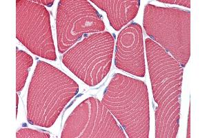 Immunohistochemistry (IHC) image for anti-Myosin Heavy Chain 7, Cardiac Muscle, beta (MYH7) (Middle Region) antibody (ABIN2776777)