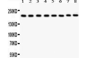 Anti- TJP1 antibody, Western blotting All lanes: Anti TJP1  at 0. (TJP1 anticorps  (AA 1178-1527))