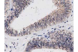 Image no. 7 for anti-Acyl-CoA Thioesterase 12 (ACOT12) antibody (ABIN1496414) (ACOT12 anticorps)