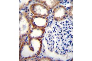 Immunohistochemistry (IHC) image for anti-Succinate Dehydrogenase Complex, Subunit D, Integral Membrane Protein (SDHD) antibody (ABIN2996554)