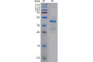 Human PTN Protein, His Tag on SDS-PAGE under reducing condition.
