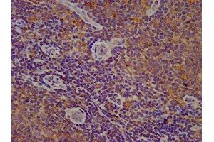 IHC image of ABIN7149098 diluted at 1:200 and staining in paraffin-embedded human lymph node tissue performed on a Leica BondTM system. (CYBA anticorps  (AA 128-195))