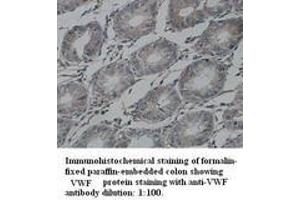 Image no. 1 for anti-Von Willebrand Factor (VWF) (Internal Region) antibody (ABIN791020) (VWF anticorps  (Internal Region))
