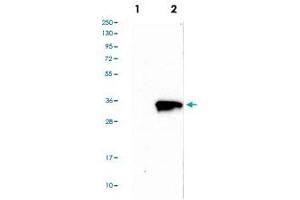 Western blot analysis of Lane 1: Negative control (vector only transfected HEK293T lysate), Lane 2: Over-expression Lysate (Co-expressed with a C-terminal myc-DDK tag (~3. (Tropomyosin anticorps  (AA 128-243))