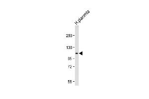 Western blot analysis of lysate from Jurkat cell line, using G Antibody (N-term) (ABIN656475 and ABIN2845755). (GAA anticorps  (N-Term))